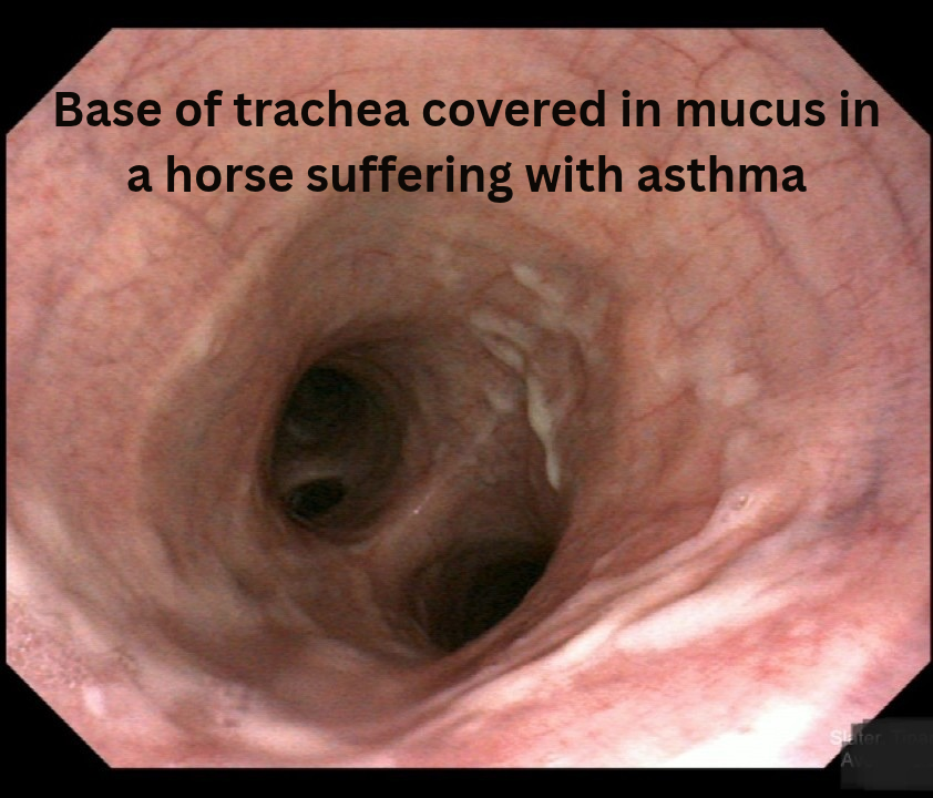 Trachea with Asthma